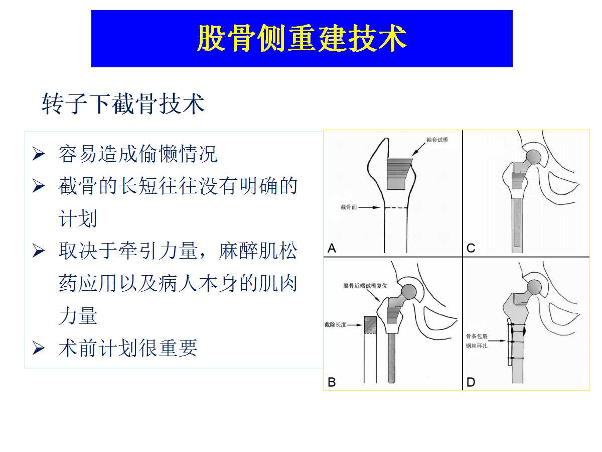 成人DDH的全髋关节置换技术