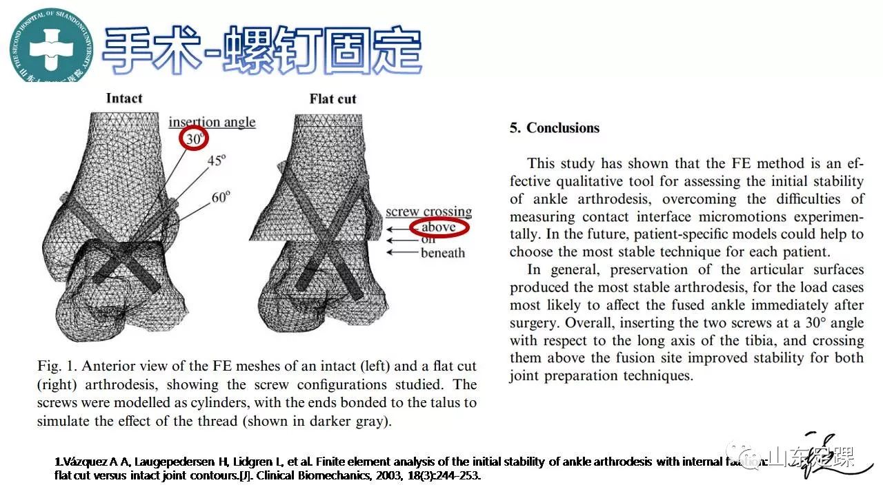 踝关节融合术的基本手术策略