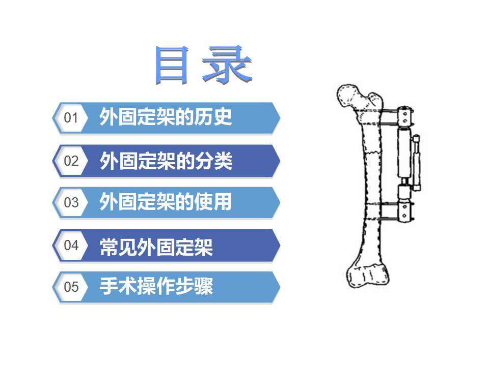 骨科常见的外固定架及其临床应用