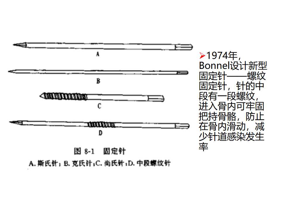 骨科常见的外固定架及其临床应用