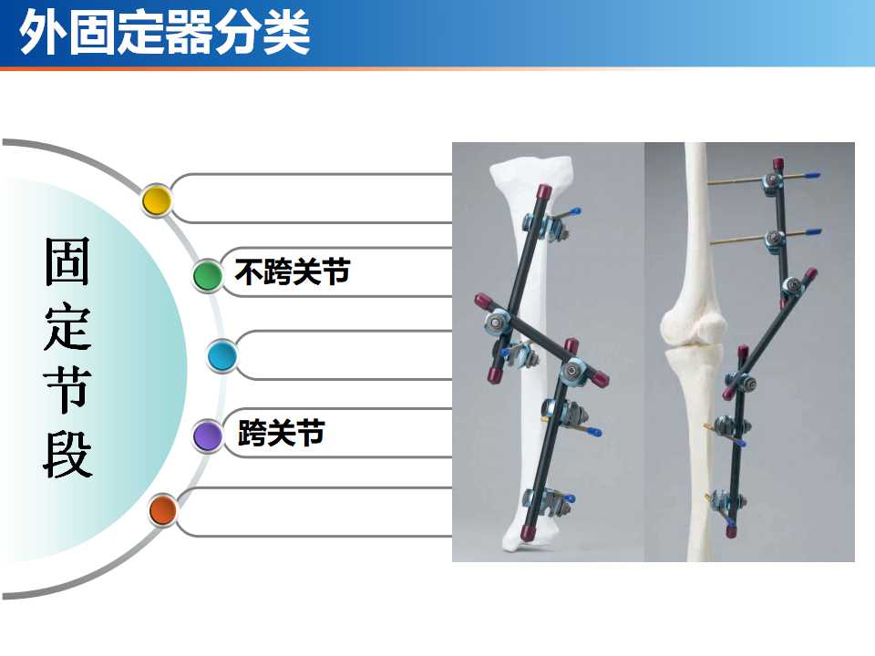 骨科常见的外固定架及其临床应用