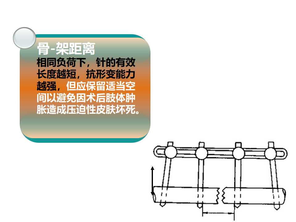 骨科常见的外固定架及其临床应用