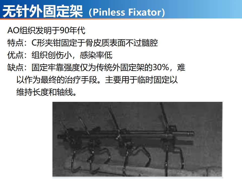 骨科常见的外固定架及其临床应用