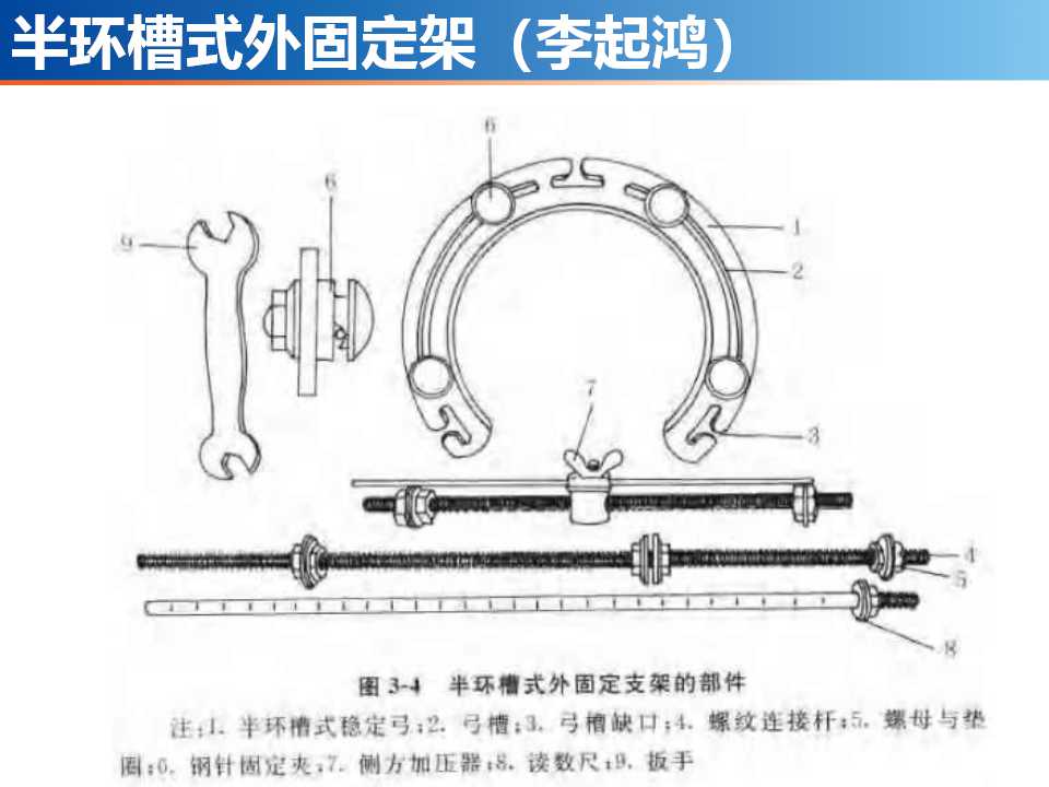 骨科常见的外固定架及其临床应用