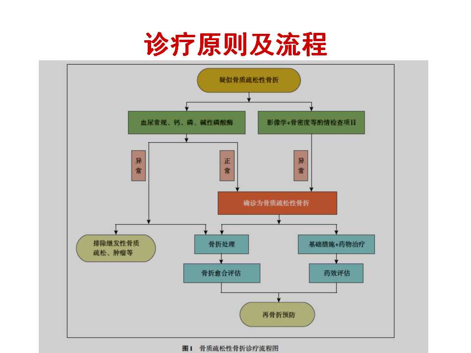 骨质疏松性骨折的手术及药物治疗