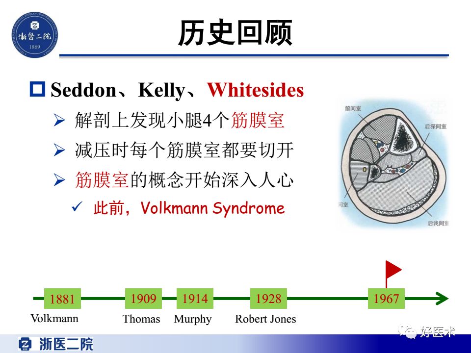 骨筋膜室综合征的诊治策略