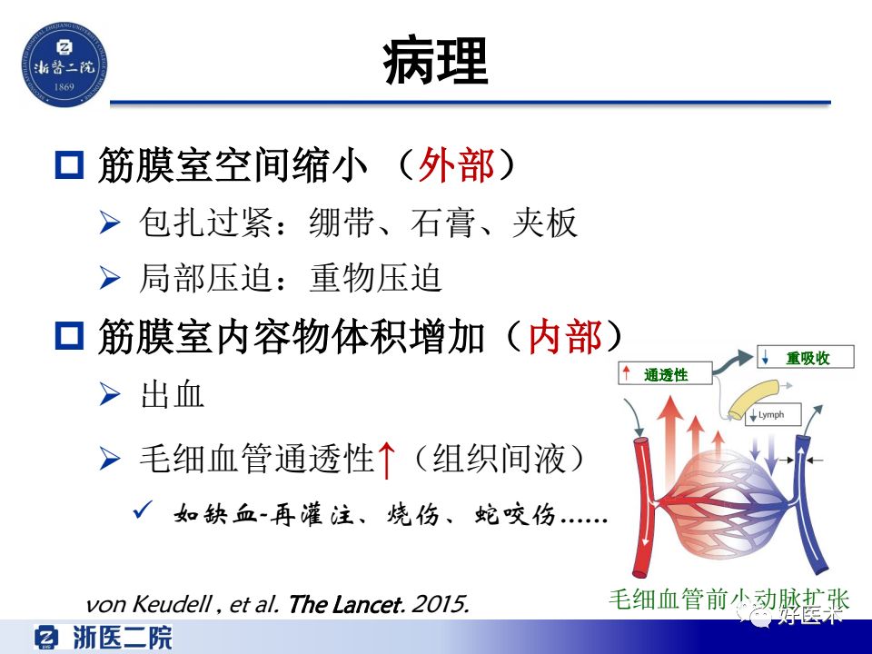 骨筋膜室综合征的诊治策略