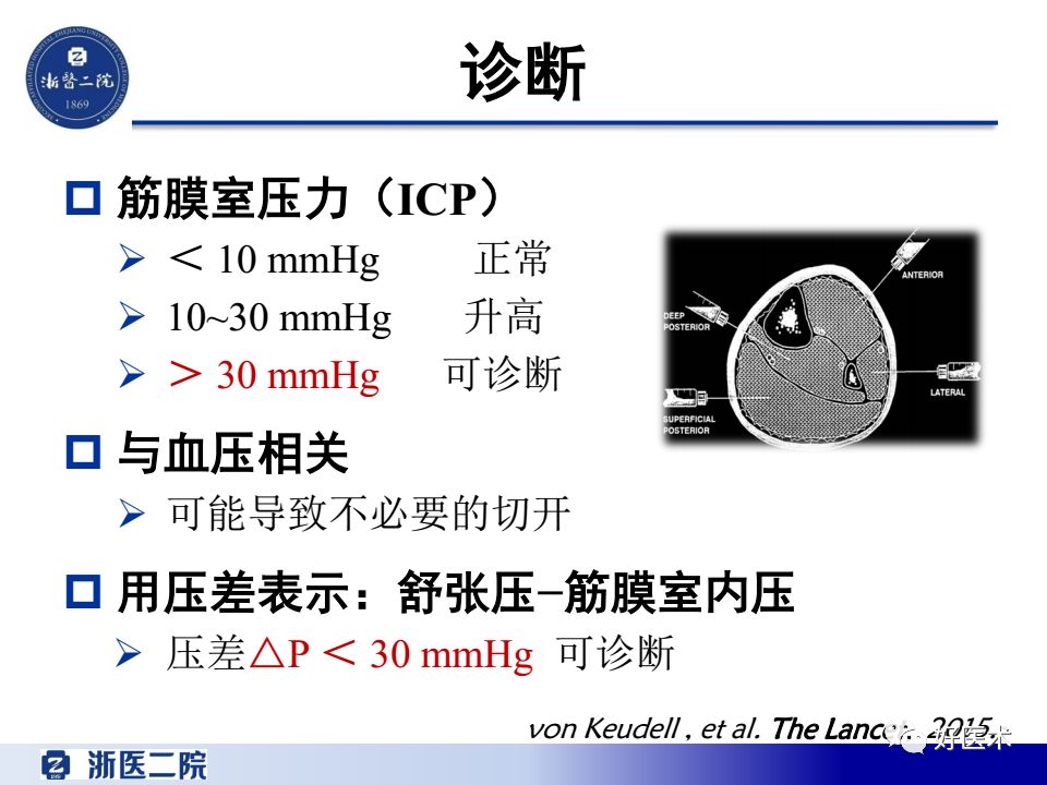 骨筋膜室综合征的诊治策略