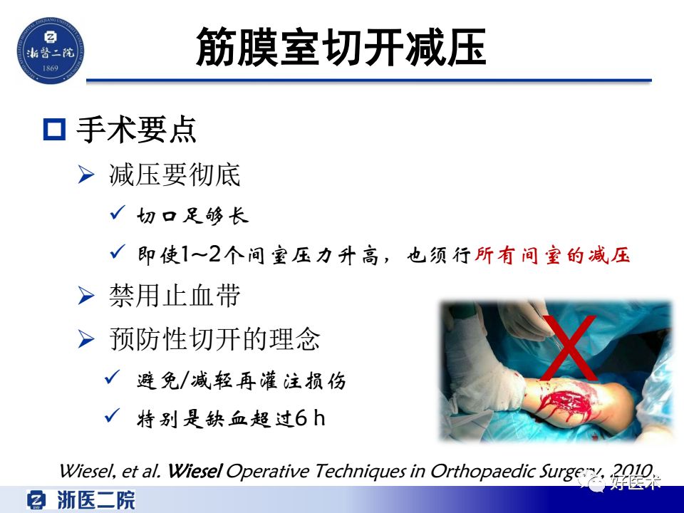 骨筋膜室综合征的诊治策略