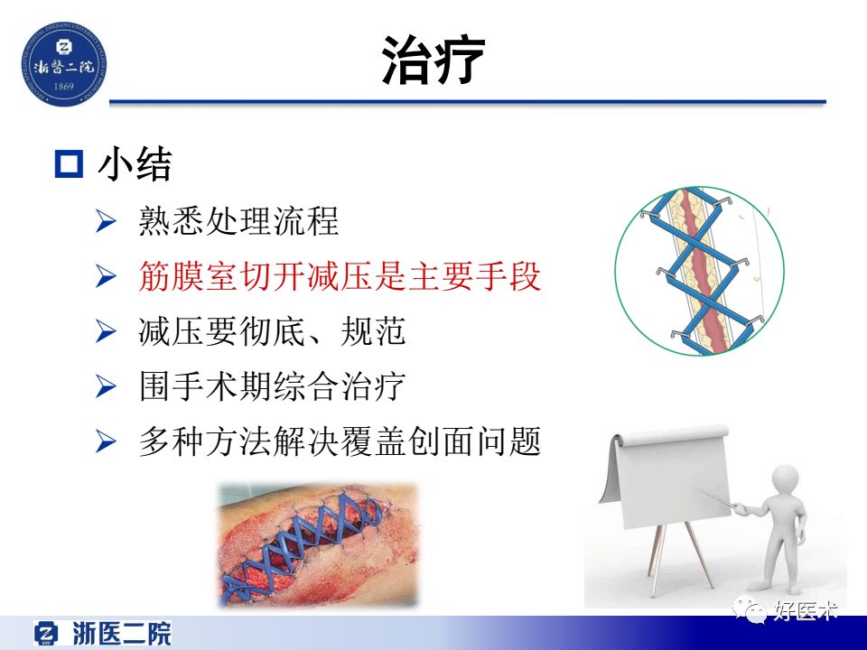 骨筋膜室综合征的诊治策略