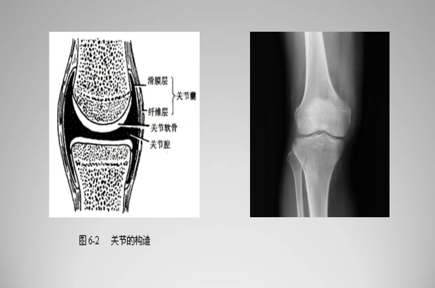 膝关节损伤MR诊断的内容及技巧