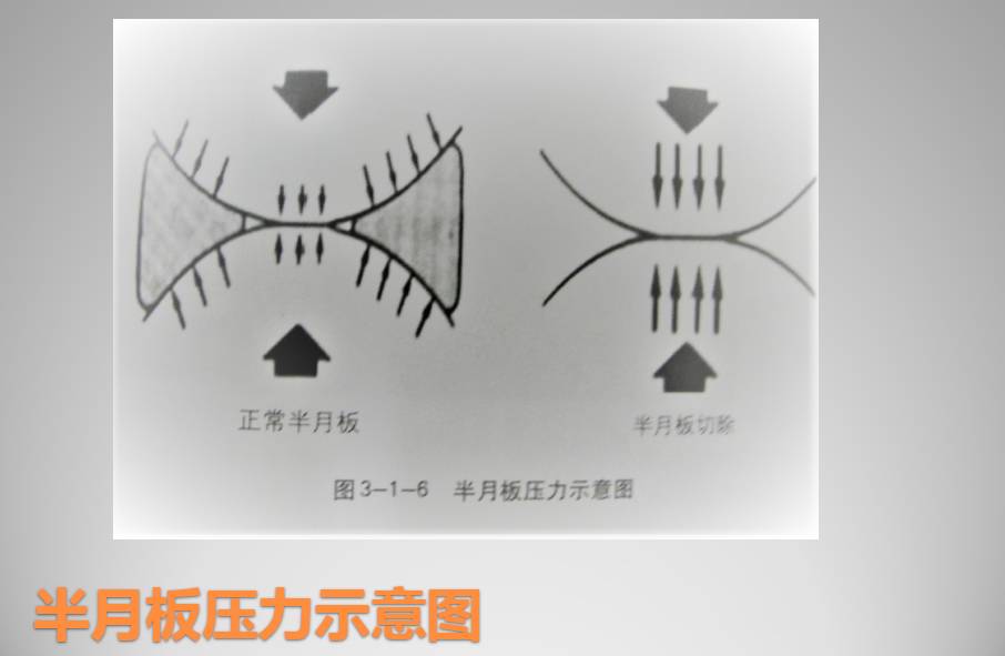 膝关节损伤MR诊断的内容及技巧