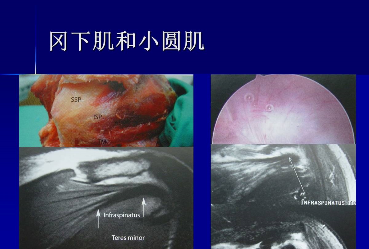 史上最全肩部体格检查汇总