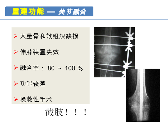 膝关节置换术后感染的防治方法