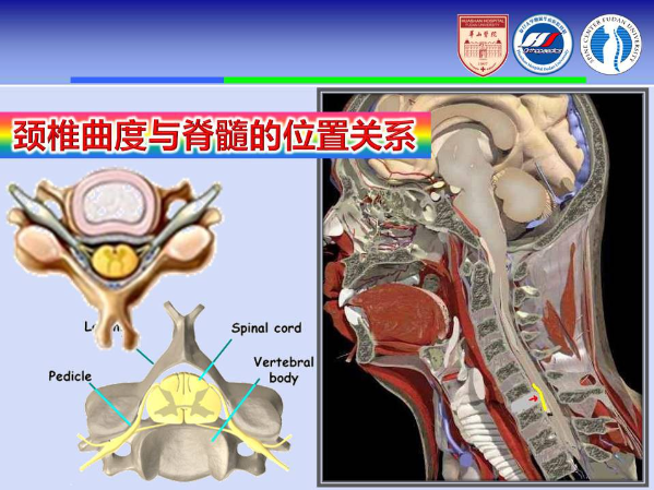 颈椎前路手术的入路解剖与临床应用