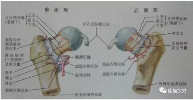 股骨头缺血性坏死的分期及诊断要点