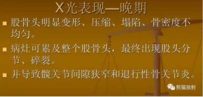 股骨头缺血性坏死的分期及诊断要点