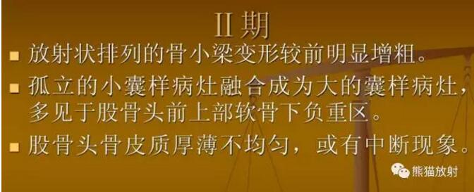 股骨头缺血性坏死的分期及诊断要点