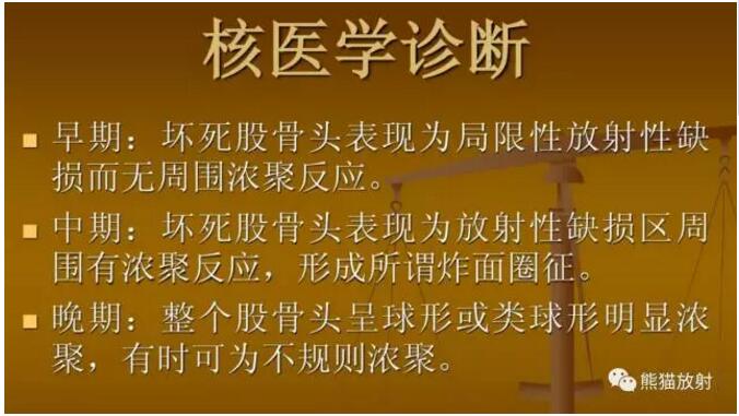 股骨头缺血性坏死的分期及诊断要点