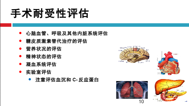 髋关节初次置换的基本原则与技术