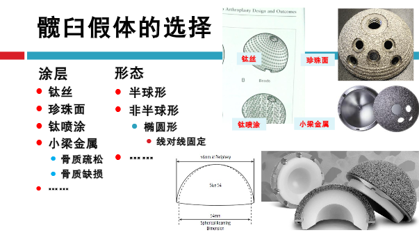 髋关节初次置换的基本原则与技术