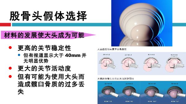 髋关节初次置换的基本原则与技术