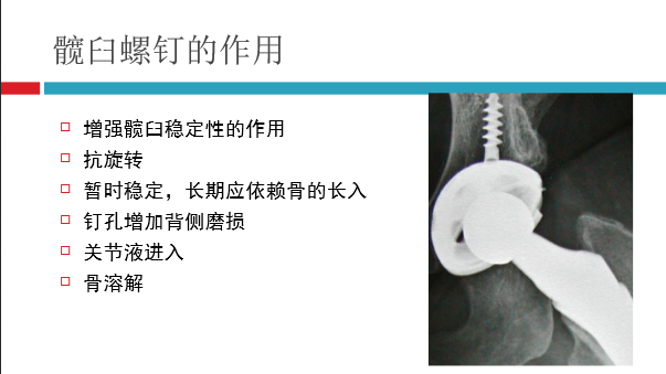 髋关节初次置换的基本原则与技术