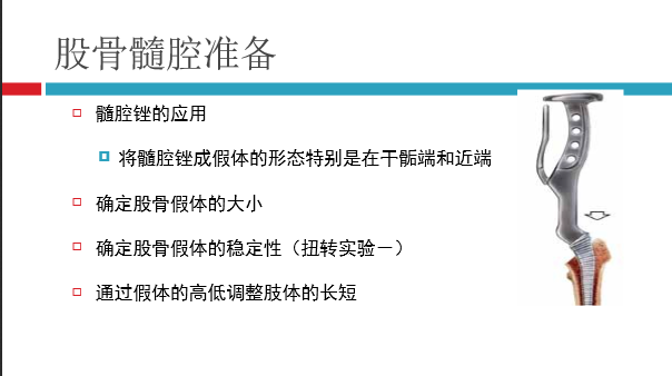 髋关节初次置换的基本原则与技术