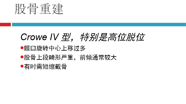 髋关节初次置换的基本原则与技术