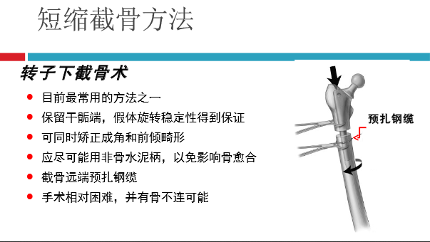 髋关节初次置换的基本原则与技术