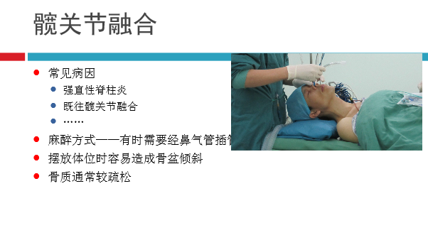 髋关节初次置换的基本原则与技术