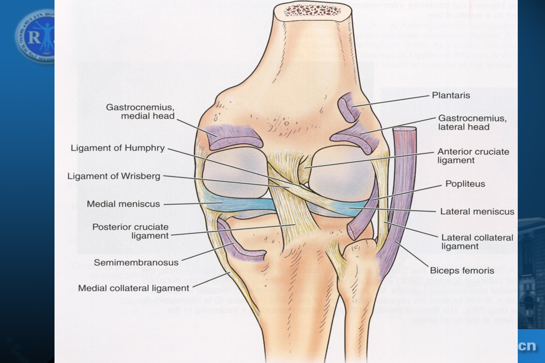 膝关节韧带损伤的MR诊断