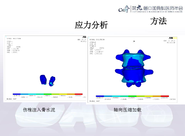 胸腰椎椎体成形术手术技巧