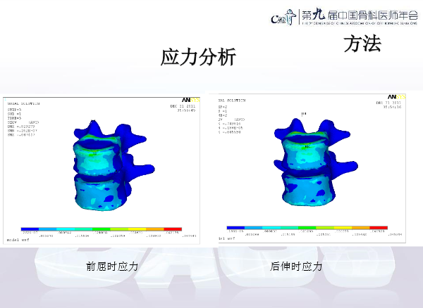 胸腰椎椎体成形术手术技巧