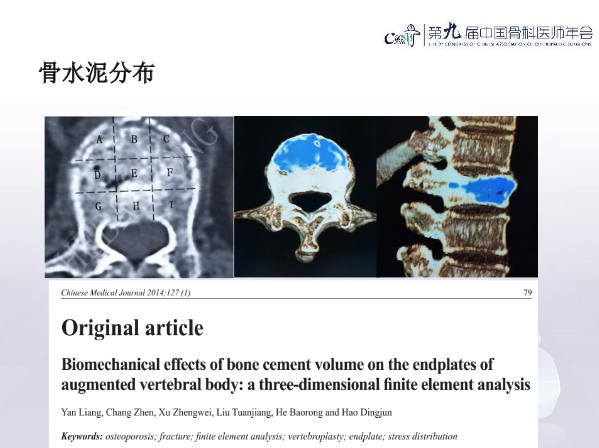 胸腰椎椎体成形术手术技巧