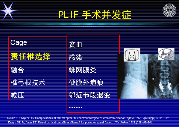 怎样判定腰椎管狭窄症的手术责任椎？