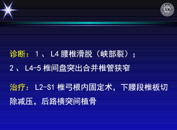 怎样判定腰椎管狭窄症的手术责任椎？