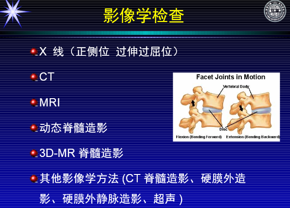 怎样判定腰椎管狭窄症的手术责任椎？