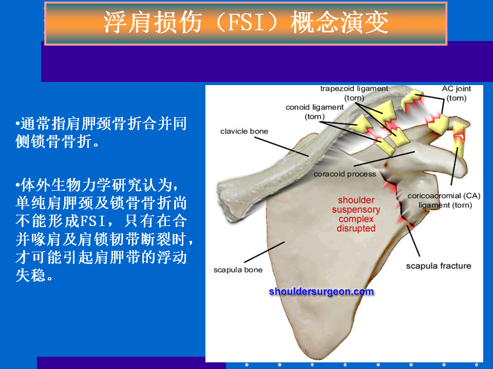 浮肩损伤的应用解剖及治疗策略