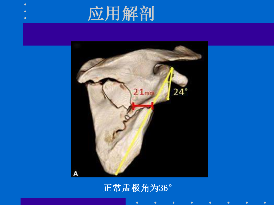 浮肩损伤的应用解剖及治疗策略