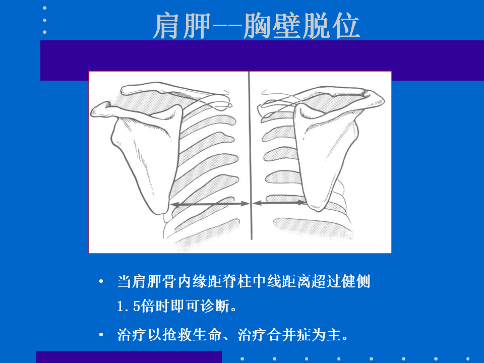 浮肩损伤的应用解剖及治疗策略