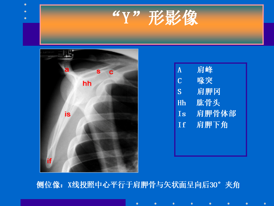 浮肩损伤的应用解剖及治疗策略