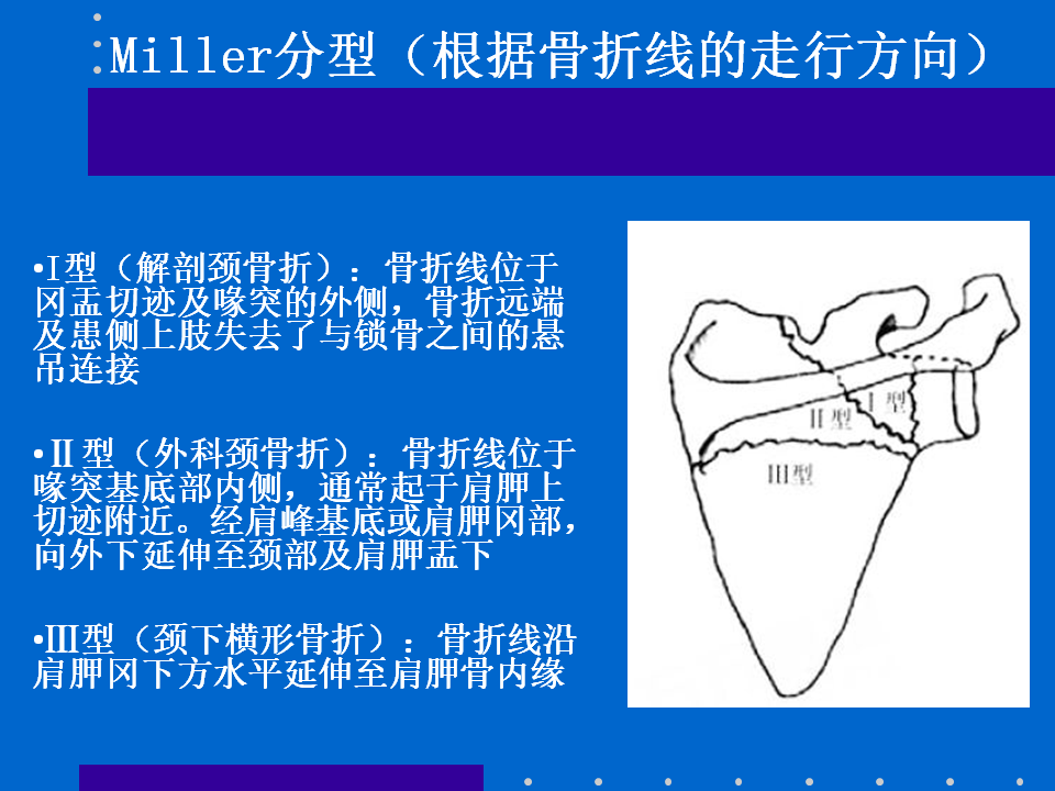 浮肩损伤的应用解剖及治疗策略