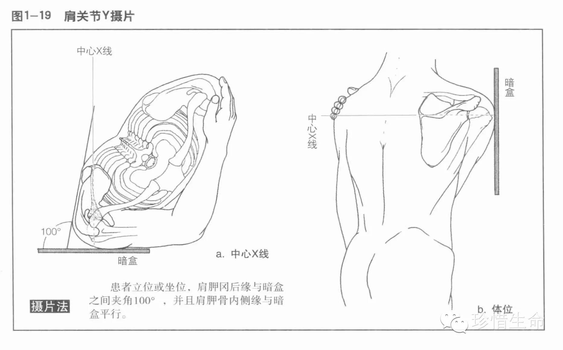 肩关节x线检查体位大全