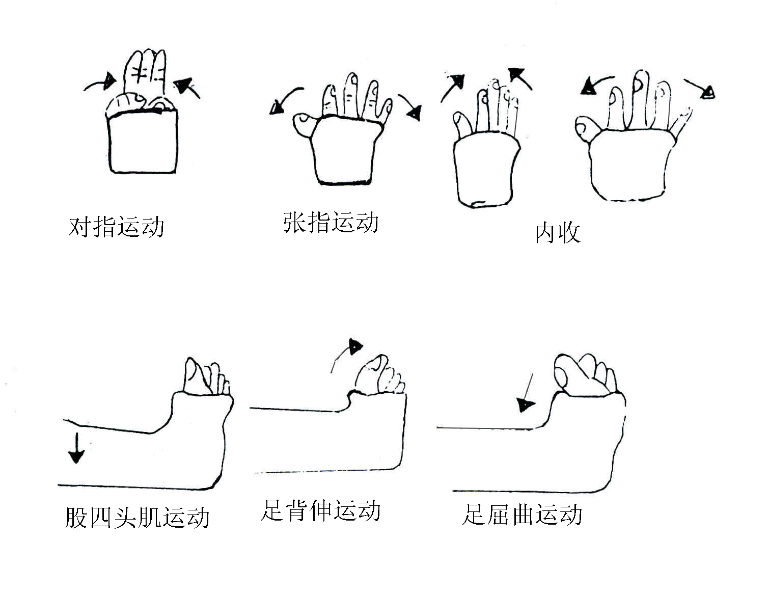 股骨髁上骨折牵引图解图片