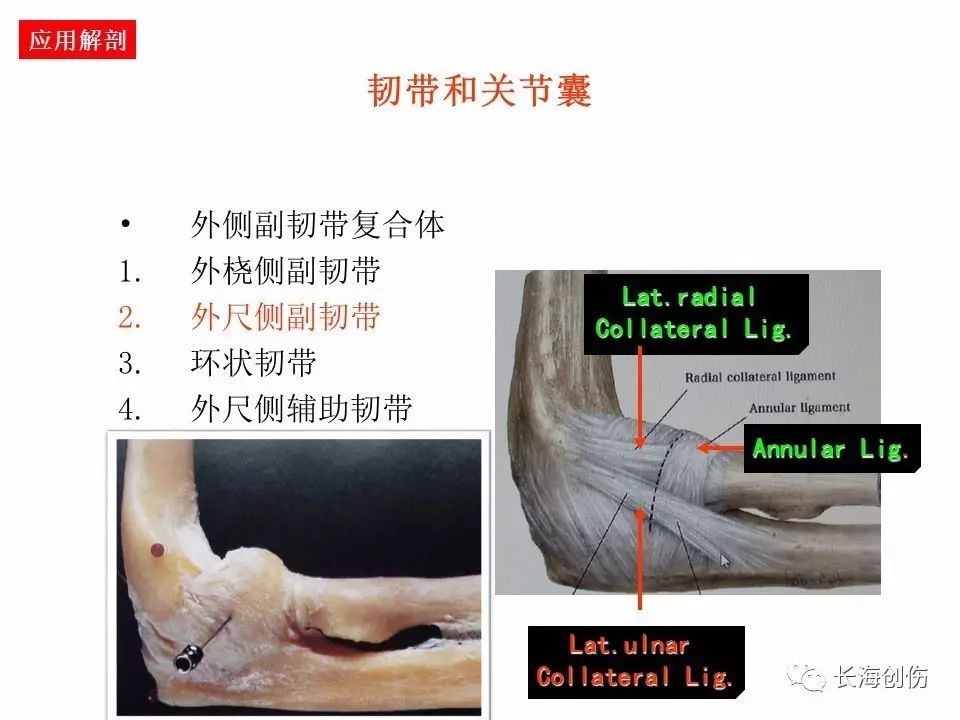 如何做好肘关节手术，先看看这篇解剖和手术入路！