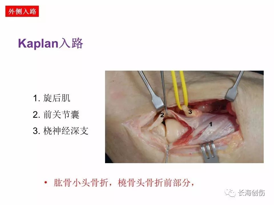 如何做好肘关节手术，先看看这篇解剖和手术入路！