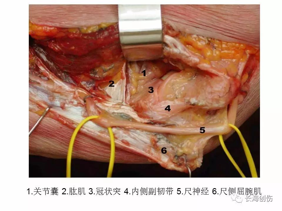 如何做好肘关节手术，先看看这篇解剖和手术入路！