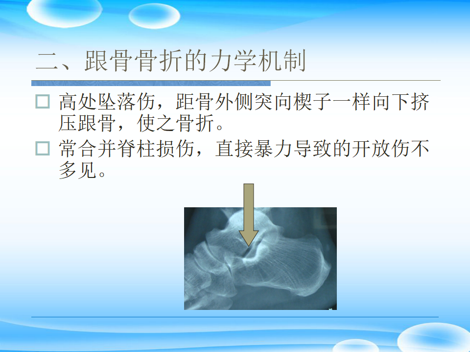 一篇掌握：跟骨ORIF十大手术技巧！