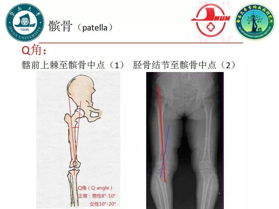 一篇掌握：膝关节X线的基本测量方法
